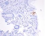 Helicobacter pylori (Catalase) Antibody in Immunohistochemistry (Paraffin) (IHC (P))