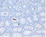 Helicobacter pylori (Catalase) Antibody in Immunohistochemistry (Paraffin) (IHC (P))