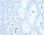 Helicobacter pylori (Catalase) Antibody in Immunohistochemistry (Paraffin) (IHC (P))