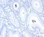 Helicobacter pylori (Catalase) Antibody in Immunohistochemistry (Paraffin) (IHC (P))