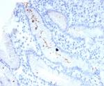 Helicobacter pylori (Catalase) Antibody in Immunohistochemistry (Paraffin) (IHC (P))