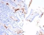 Helicobacter pylori (Catalase) Antibody in Immunohistochemistry (Paraffin) (IHC (P))