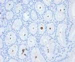 Helicobacter pylori (Catalase) Antibody in Immunohistochemistry (Paraffin) (IHC (P))