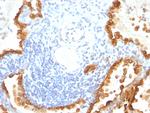 Cytokeratin 8/18 Antibody in Immunohistochemistry (Paraffin) (IHC (P))