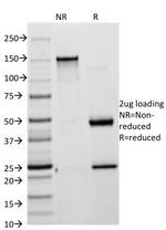 Cytokeratin 8/18 Antibody in SDS-PAGE (SDS-PAGE)