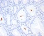 Helicobacter pylori (Catalase) Antibody in Immunohistochemistry (Paraffin) (IHC (P))