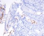 Helicobacter pylori (Catalase) Antibody in Immunohistochemistry (Paraffin) (IHC (P))