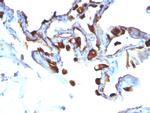 Cytokeratin 8/18 Antibody in Immunohistochemistry (Paraffin) (IHC (P))