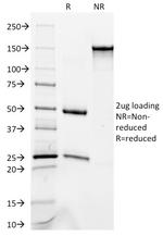 Cytokeratin 8/18 Antibody in SDS-PAGE (SDS-PAGE)