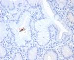 Helicobacter pylori (Catalase) Antibody in Immunohistochemistry (Paraffin) (IHC (P))