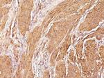 Actin, Muscle Specific (Muscle Cell Marker) Antibody in Immunohistochemistry (Paraffin) (IHC (P))