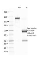 Epstein-Barr Virus (LMP-1) Antibody in SDS-PAGE (SDS-PAGE)