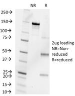 Progesterone Antibody in SDS-PAGE (SDS-PAGE)