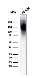 Neurofilament (H+L) (Neuronal Marker) Antibody in Western Blot (WB)