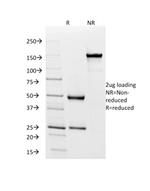 HLA-Pan (MHC II) Antibody in SDS-PAGE (SDS-PAGE)