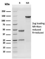 Human Herpes Virus 8 (HHV8) Antibody in SDS-PAGE (SDS-PAGE)