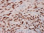 Human Herpes Virus 8 (HHV8) Antibody in Immunohistochemistry (Paraffin) (IHC (P))