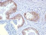 Pan-Cadherin Antibody in Immunohistochemistry (Paraffin) (IHC (P))