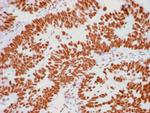 Human Nucleolar Antigen Antibody in Immunohistochemistry (Paraffin) (IHC (P))