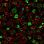 Human Nucleolar Antigen Antibody in Immunocytochemistry (ICC/IF)