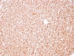 Human Nucleolar Antigen Antibody in Immunohistochemistry (Paraffin) (IHC (P))