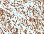 Actin, Muscle Specific (Muscle Cell Marker) Antibody in Immunohistochemistry (Paraffin) (IHC (P))