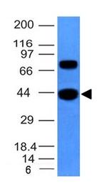 Actin, Muscle Specific (Muscle Cell Marker) Antibody in Western Blot (WB)