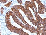 Cytokeratin 8/18 Antibody in Immunohistochemistry (Paraffin) (IHC (P))