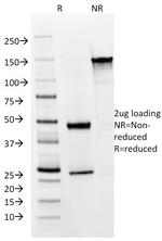 Cytokeratin 8/18 Antibody in SDS-PAGE (SDS-PAGE)