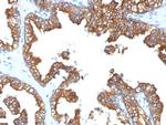 Cytokeratin 8/18 Antibody in Immunohistochemistry (Paraffin) (IHC (P))