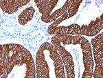 Cytokeratin 8/18 Antibody in Immunohistochemistry (Paraffin) (IHC (P))