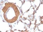 Actin, Muscle Specific (Muscle Cell Marker) Antibody in Immunohistochemistry (Paraffin) (IHC (P))