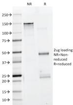 Actin, Muscle Specific (Muscle Cell Marker) Antibody in SDS-PAGE (SDS-PAGE)