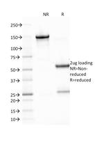 Epstein-Barr Virus (LMP-1) Antibody in SDS-PAGE (SDS-PAGE)