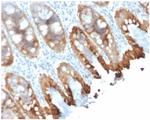 Cytokeratin 8/18 Antibody in Immunohistochemistry (Paraffin) (IHC (P))