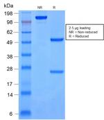 Cytokeratin 8/18 Antibody in SDS-PAGE (SDS-PAGE)