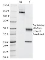 Cytokeratin 5/6 (Basal, Myoepithelial and Mesothelial Cell Marker) Antibody in SDS-PAGE (SDS-PAGE)