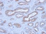 Cytokeratin, pan (Epithelial Marker) Antibody in Immunohistochemistry (Paraffin) (IHC (P))