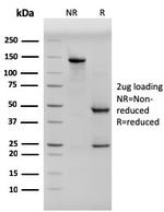 Cytokeratin, pan (Epithelial Marker) Antibody in SDS-PAGE (SDS-PAGE)