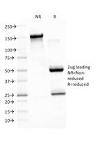 Epstein-Barr Virus (LMP-1) Antibody in SDS-PAGE (SDS-PAGE)