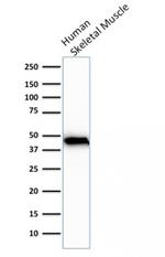 Actin, Muscle Specific (Muscle Cell Marker) Antibody in Western Blot (WB)