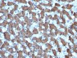 HepPar-1 Antibody in Immunohistochemistry (Paraffin) (IHC (P))