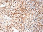 HSV1 (Herpes Simplex Virus Type I) Antibody in Immunohistochemistry (Paraffin) (IHC (P))