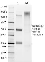 Helicobacter pylori Antibody in SDS-PAGE (SDS-PAGE)