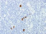 Epstein-Barr Virus (LMP-1) Antibody in Immunohistochemistry (Paraffin) (IHC (P))