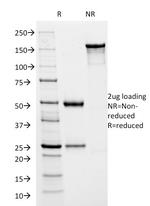 HSV1 (Herpes Simplex Virus Type I) ICP8 Antibody in SDS-PAGE (SDS-PAGE)