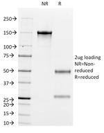 Cytokeratin 8/18 Antibody in SDS-PAGE (SDS-PAGE)