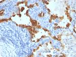 Cytokeratin 8/18 Antibody in Immunohistochemistry (Paraffin) (IHC (P))