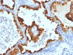 Cytokeratin 8/18 Antibody in Immunohistochemistry (Paraffin) (IHC (P))