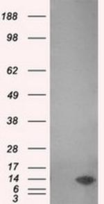 MSMB Antibody in Western Blot (WB)